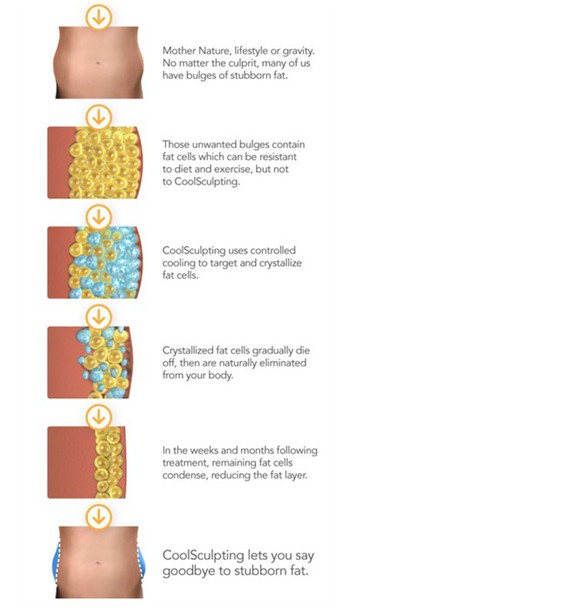Multipolar আরএফ Cryolipolysis স্লিমিং মেশিন / ফেস লিফ্ট, ফ্যাট ফ্রিজ সরঞ্জাম